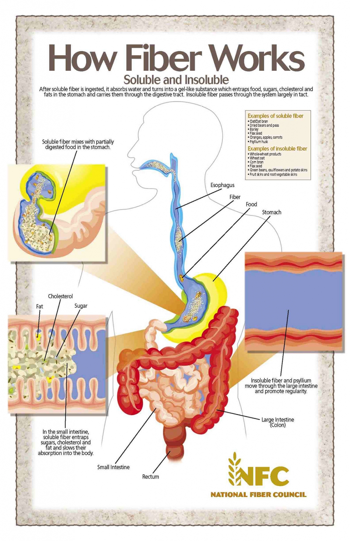 How Fiber Works - Health Infographic How Fiber Works - Health Infographic