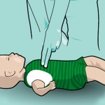 How to Perform CPR on an Infant
