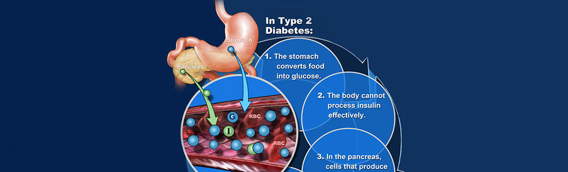 Diabetes Facts and Statistics Infographic